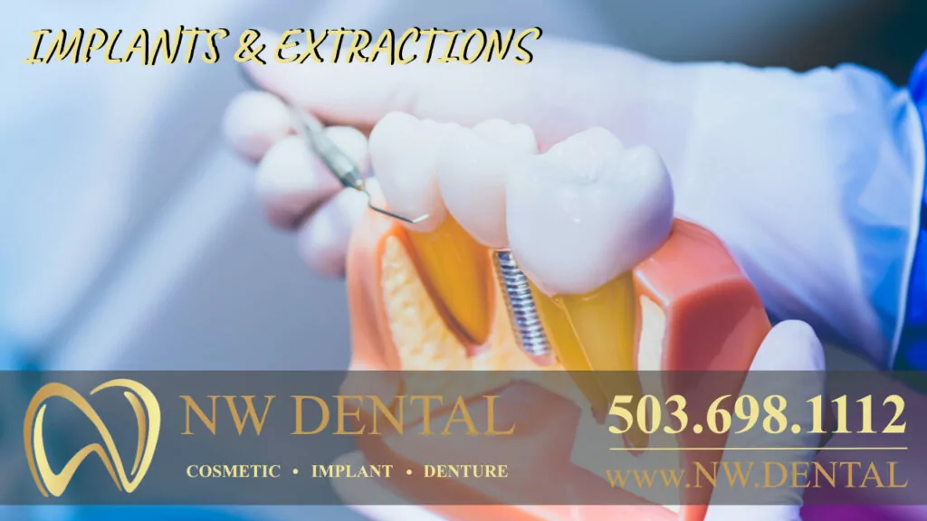 Clackamas Dentist Cosmetic and Emergency dentists implants and extractions in Clackamas Oregon