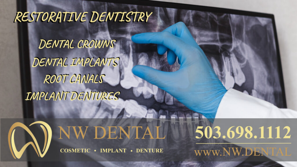 NW Dental in Clackamas Oregon dentists restorative dentistry dental crowns, bridges, dental implants, root canals, dentures Clackamas dentist