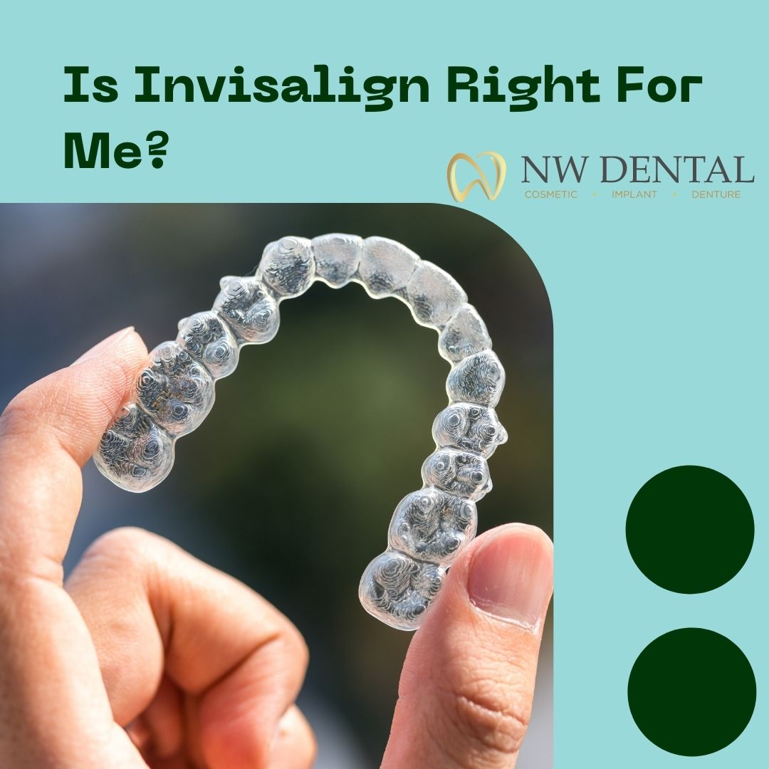 Is Invisalign Right For Me?