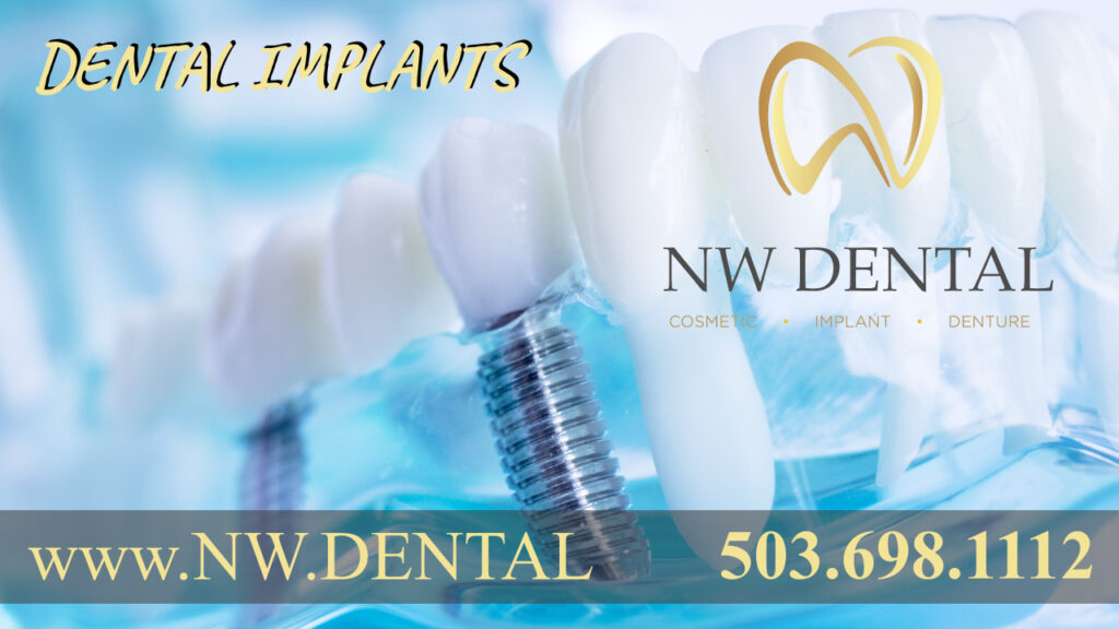 NW Dental in Damascus Oregon dentists cosmetic and emergency dentist dental implants implant dentistry