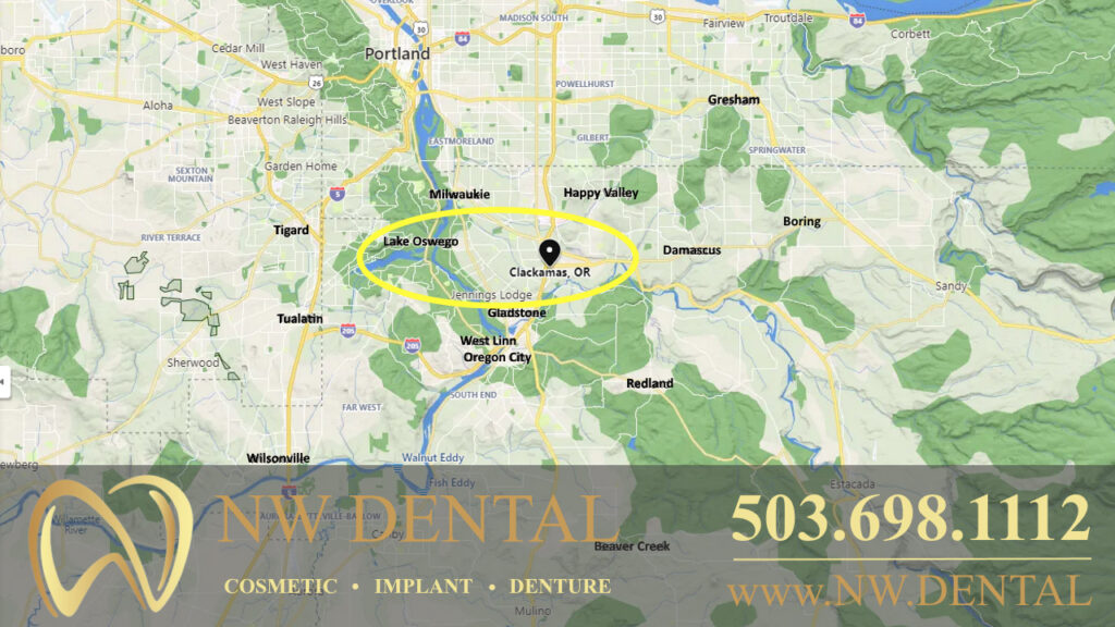 Lake Oswego Dentist Map of Dentist Offices and dental practices near Lake Oswego, Oregon in Clackamas County