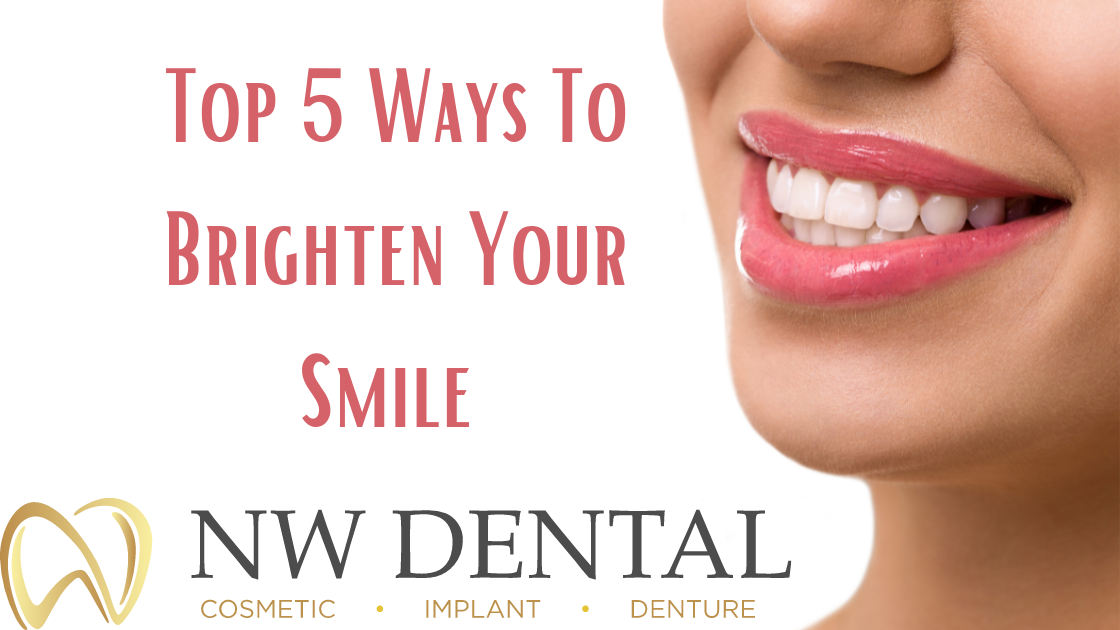 Top 5 Ways To Brighten Your Smile