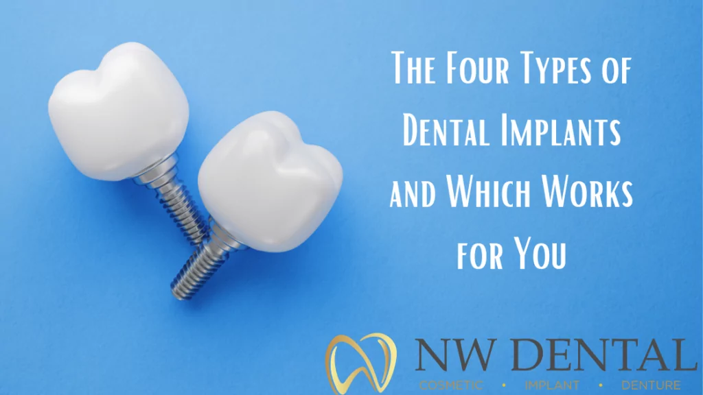 The Four Types of Dental Implants and Which Works for You